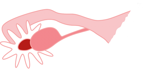 e10c2e6dc61dd468d644a8a0616ed918_1457750
